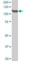 EPH receptor A3 antibody, H00002042-M02, Novus Biologicals, Western Blot image 