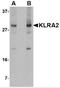 Killer cell lectin-like receptor 2 antibody, 5017, ProSci Inc, Western Blot image 