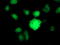 Baculoviral IAP Repeat Containing 5 antibody, LS-C172543, Lifespan Biosciences, Immunofluorescence image 