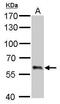 Glutamate Decarboxylase 1 antibody, PA5-21397, Invitrogen Antibodies, Western Blot image 