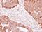 NADH:Ubiquinone Oxidoreductase Subunit AB1 antibody, GTX114573, GeneTex, Immunohistochemistry paraffin image 