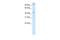 Pogo Transposable Element Derived With ZNF Domain antibody, ARP39172_T100, Aviva Systems Biology, Western Blot image 