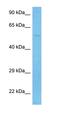 Origin recognition complex subunit 4 antibody, orb327316, Biorbyt, Western Blot image 