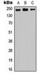 Mediator Complex Subunit 12 antibody, LS-C356180, Lifespan Biosciences, Western Blot image 