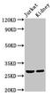 Msh Homeobox 2 antibody, LS-C670460, Lifespan Biosciences, Western Blot image 