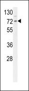 DnaJ Heat Shock Protein Family (Hsp40) Member C2 antibody, 64-166, ProSci, Western Blot image 