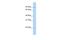 Transmembrane And Coiled-Coil Domain Family 2 antibody, PA5-69174, Invitrogen Antibodies, Western Blot image 