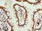 Alkaline Phosphatase, Biomineralization Associated antibody, LS-C375205, Lifespan Biosciences, Immunohistochemistry paraffin image 