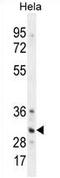 TNFRSF1A Associated Via Death Domain antibody, AP54350PU-N, Origene, Western Blot image 