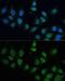 Carbamoyl-Phosphate Synthase 1 antibody, GTX64501, GeneTex, Immunocytochemistry image 