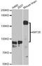 Lysine Methyltransferase 2E antibody, STJ27895, St John