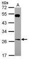 RAB26, Member RAS Oncogene Family antibody, PA5-31287, Invitrogen Antibodies, Western Blot image 