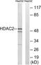 Histone Deacetylase 2 antibody, LS-B6853, Lifespan Biosciences, Western Blot image 