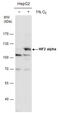 HIF-2-alpha antibody, GTX128793, GeneTex, Western Blot image 