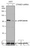 Catenin Delta 1 antibody, GTX130448, GeneTex, Western Blot image 