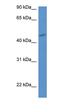 Major Histocompatibility Complex, Class II, DQ Alpha 2 antibody, orb330587, Biorbyt, Western Blot image 