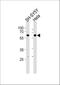 Histone Deacetylase 2 antibody, A00325-2, Boster Biological Technology, Western Blot image 
