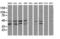 Mitogen-Activated Protein Kinase Kinase 3 antibody, LS-C337936, Lifespan Biosciences, Western Blot image 