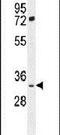 FSHD Region Gene 2 Family Member B antibody, PA5-24547, Invitrogen Antibodies, Western Blot image 