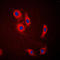 Solute Carrier Family 24 Member 1 antibody, LS-C353140, Lifespan Biosciences, Immunofluorescence image 