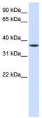 LIM Homeobox 8 antibody, TA342390, Origene, Western Blot image 