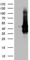 Transforming Acidic Coiled-Coil Containing Protein 2 antibody, TA803720, Origene, Western Blot image 