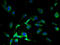 Solute Carrier Family 38 Member 7 antibody, A61002-100, Epigentek, Immunofluorescence image 