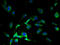 Putative sodium-coupled neutral amino acid transporter 7 antibody, A61002-100, Epigentek, Immunofluorescence image 