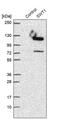 SWT1 RNA Endoribonuclease Homolog antibody, PA5-55016, Invitrogen Antibodies, Western Blot image 