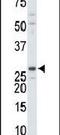 Thymidylate kinase antibody, PA5-13812, Invitrogen Antibodies, Western Blot image 