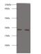 Serine Protease 3 antibody, LS-C211416, Lifespan Biosciences, Western Blot image 