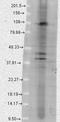 Transient Receptor Potential Cation Channel Subfamily C Member 4 antibody, LS-B6722, Lifespan Biosciences, Western Blot image 