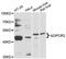 Adiponectin Receptor 2 antibody, LS-C747852, Lifespan Biosciences, Western Blot image 