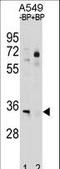 ATPase Na+/K+ Transporting Subunit Beta 2 antibody, LS-C157564, Lifespan Biosciences, Western Blot image 