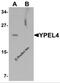 Yippee Like 4 antibody, 6777, ProSci, Western Blot image 