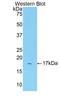 Interleukin 1 Receptor Type 1 antibody, LS-C373875, Lifespan Biosciences, Western Blot image 