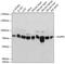 Nucleoporin 93 antibody, 19-345, ProSci, Western Blot image 