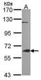 Growth Factor Receptor Bound Protein 7 antibody, GTX100296, GeneTex, Western Blot image 