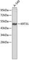Hair keratin, type I Ha1 antibody, 18-755, ProSci, Western Blot image 
