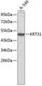 Keratin 31 antibody, 18-755, ProSci, Western Blot image 