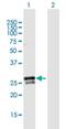 RAB3B, Member RAS Oncogene Family antibody, H00005865-B02P, Novus Biologicals, Western Blot image 