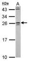 GRB2 Related Adaptor Protein antibody, PA5-30404, Invitrogen Antibodies, Western Blot image 