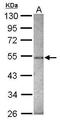Zinc Finger Protein 213 antibody, GTX116215, GeneTex, Western Blot image 