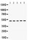 Syndecan 1 antibody, PB9743, Boster Biological Technology, Western Blot image 