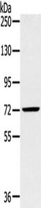 Solute Carrier Family 27 Member 5 antibody, TA351693, Origene, Western Blot image 