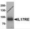 Interleukin 17 Receptor E antibody, 7181, ProSci Inc, Western Blot image 