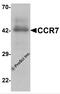 C-C Motif Chemokine Receptor 7 antibody, 7649, ProSci, Western Blot image 