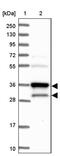 Heme Oxygenase 2 antibody, PA5-59222, Invitrogen Antibodies, Western Blot image 