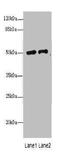 Phospholipase A2 Group VII antibody, A55383-100, Epigentek, Western Blot image 