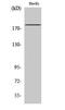 Erb-B2 Receptor Tyrosine Kinase 3 antibody, STJ92973, St John